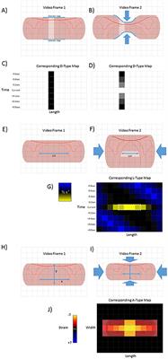 Quantifying Patterns of Smooth Muscle Motility in the Gut and Other Organs With New Techniques of Video Spatiotemporal Mapping